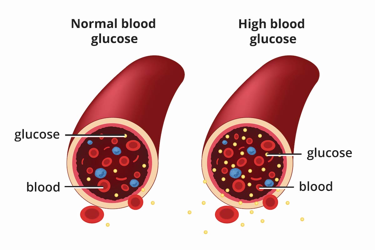 Blood Sugar Support Formula for Gluco Grove